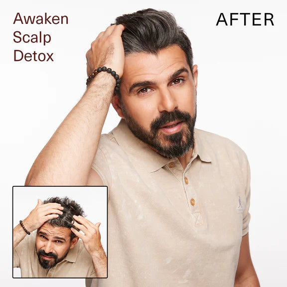 AWAKEN -  Scalp Detox