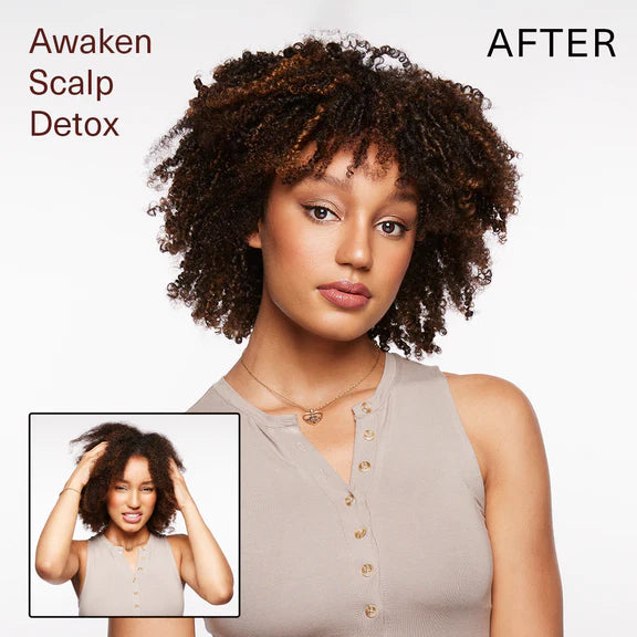 AWAKEN -  Scalp Detox